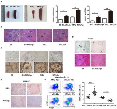 Predominant Role of Immunoglobulin G in the Pathogenesis of Splenomegaly in Murine Lupus